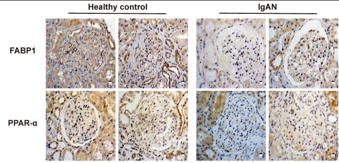 Levels of FABP1 and PPARα were decreased in IgAN renal tissues.jpg
